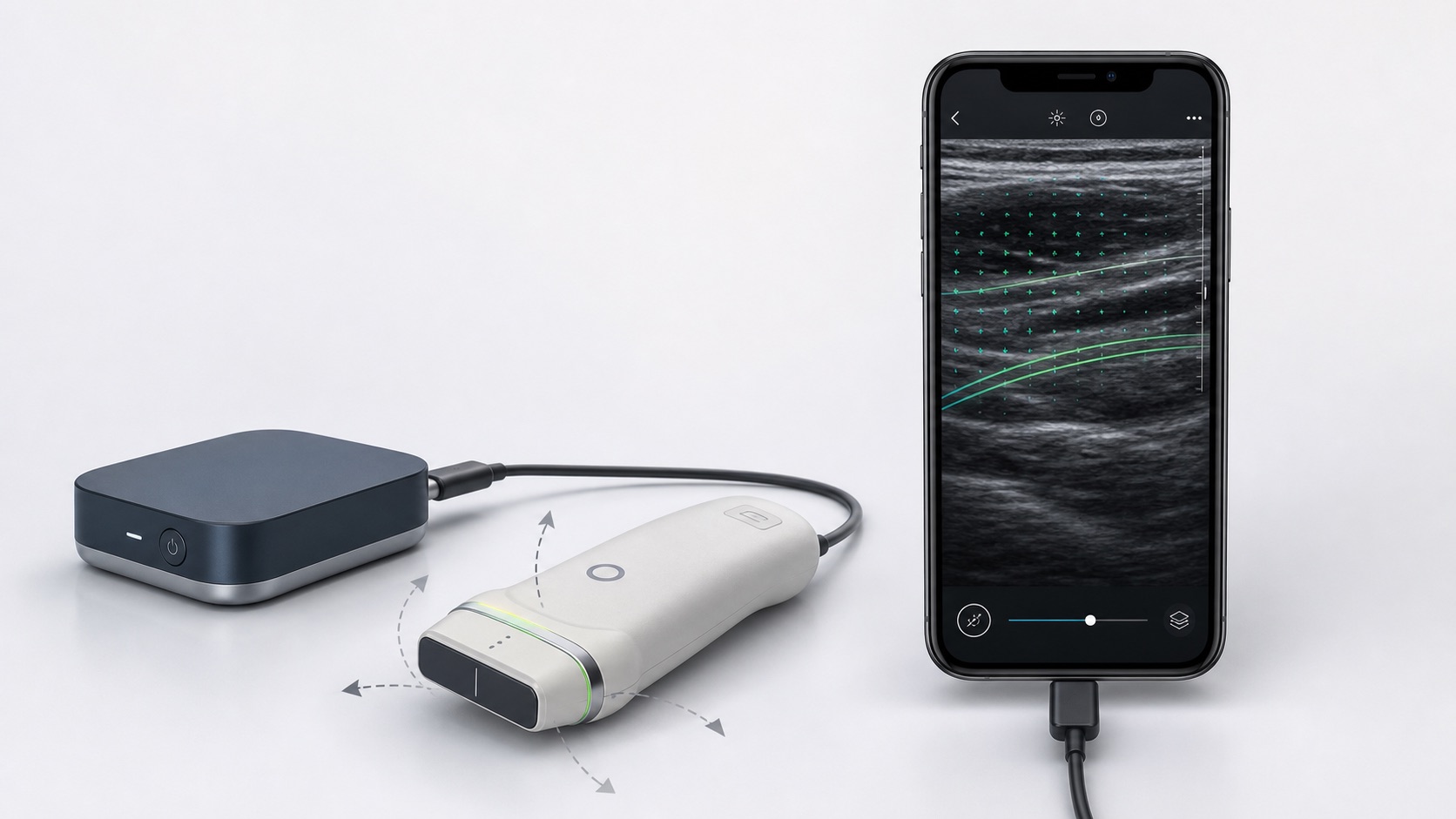 Concept rendering of a generic phone-connected ultrasound probe and external acquisition module displaying directional research vectors